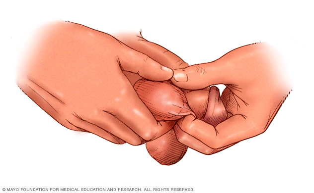 Illustration of testicular self-examination