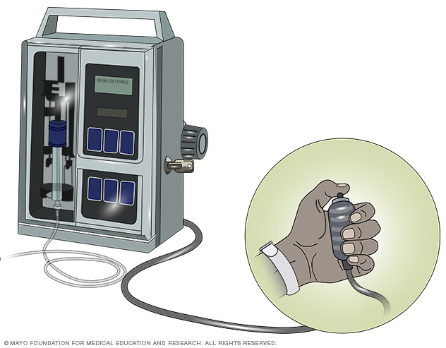 Patient-controlled analgesia (PCA) system