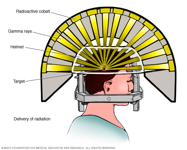 The headpiece and gamma ray delivery