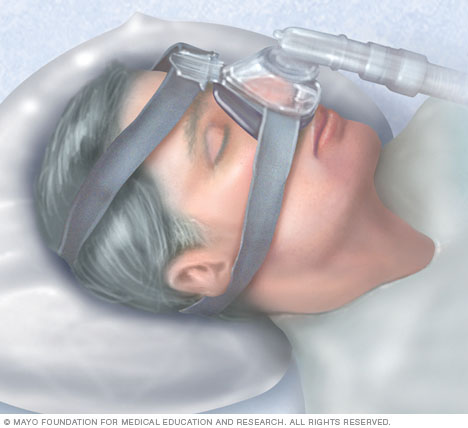 10 Trucos para respirar mejor por la noche - Descubre cómo conciliar el  sueño con congestión nasal