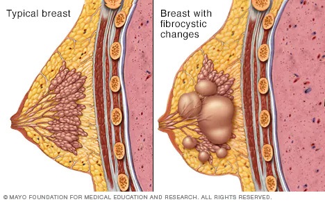 Price-Wise Wonder Breast changes and conditions after childbirth