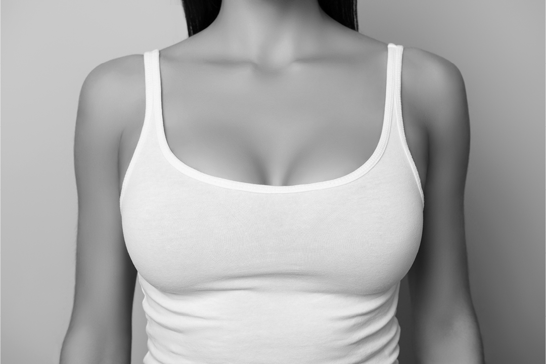 breast plastic surgery option