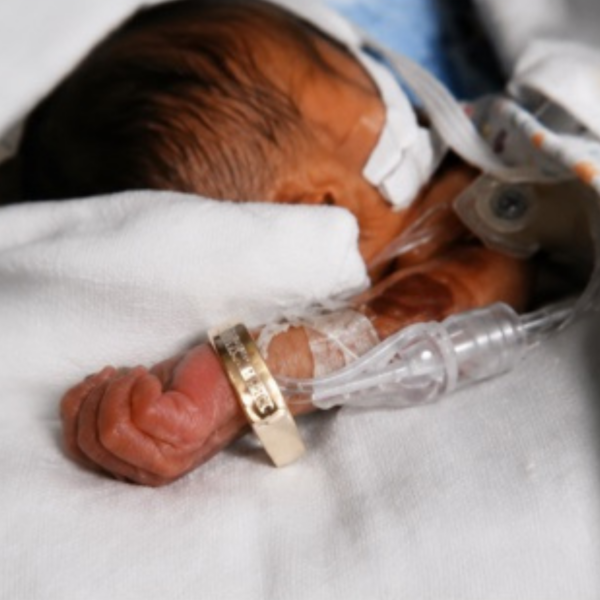Romie Granger in the NICU in 2006, wearing his father's wedding ring as a bracelet.